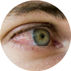 closeup of a bloodshot eye