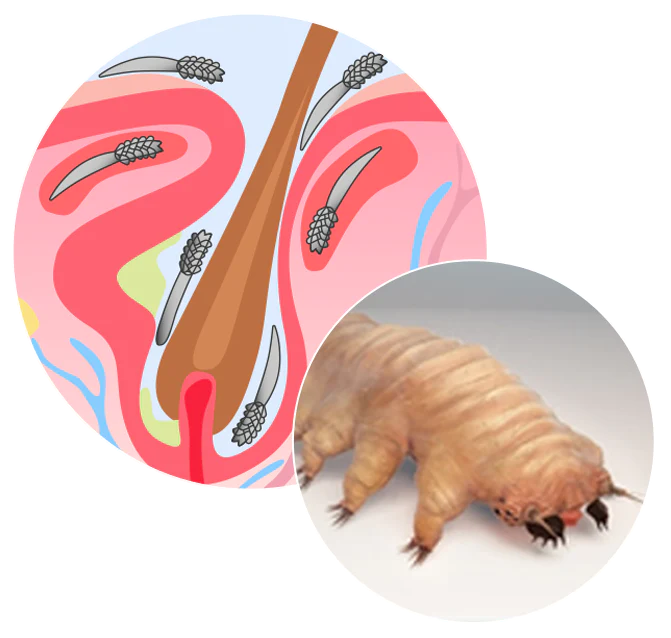 Two pictures: one - EXTREME close up of a Demodex mite , Two - Stylized drawing of a hair folicle covered in said mites. I'm sorry you had to hear that.