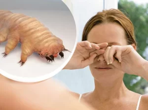 Woman rubbing her eyes with an insert of an extremely magnified demodex mite